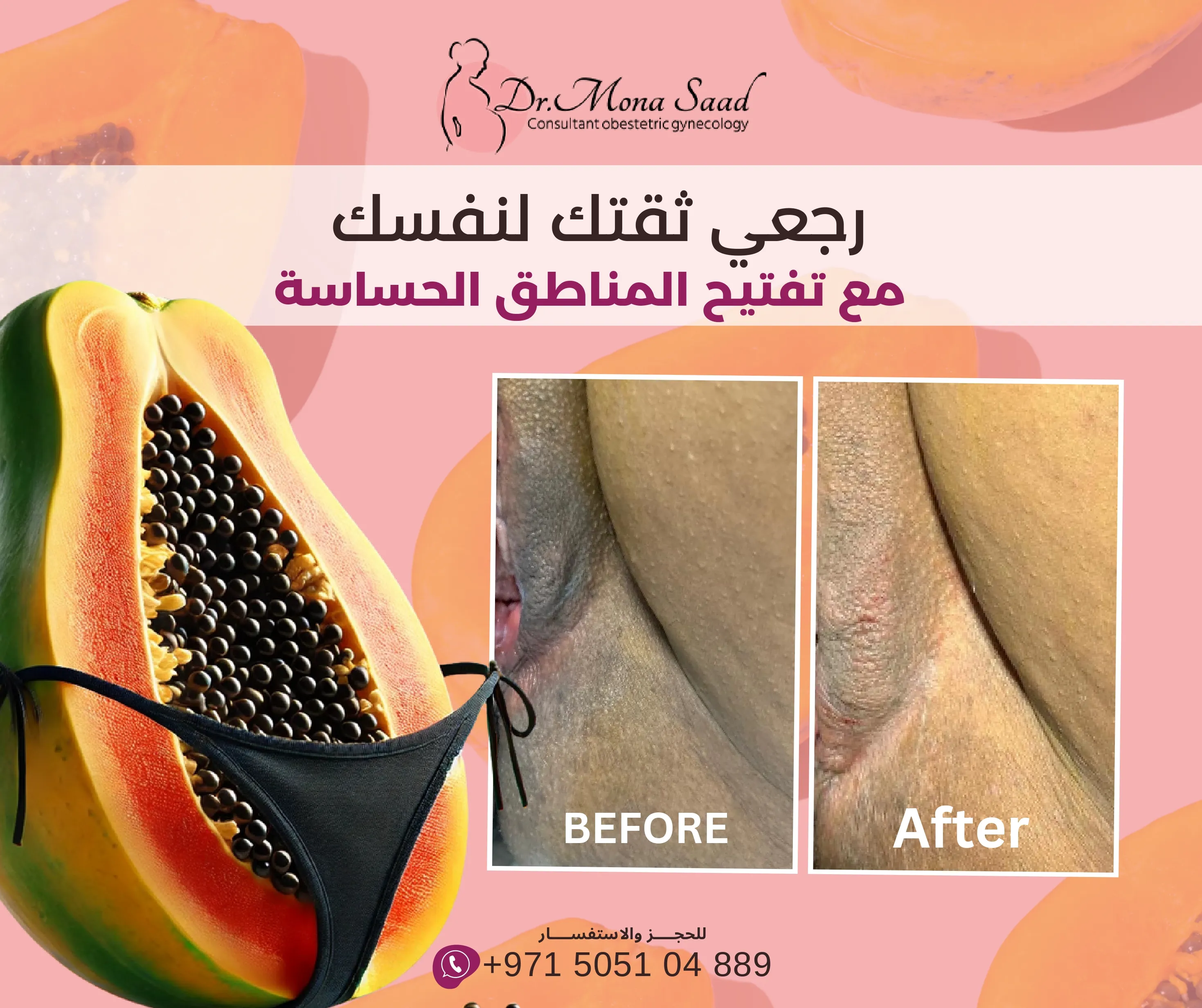 Before / After 4
