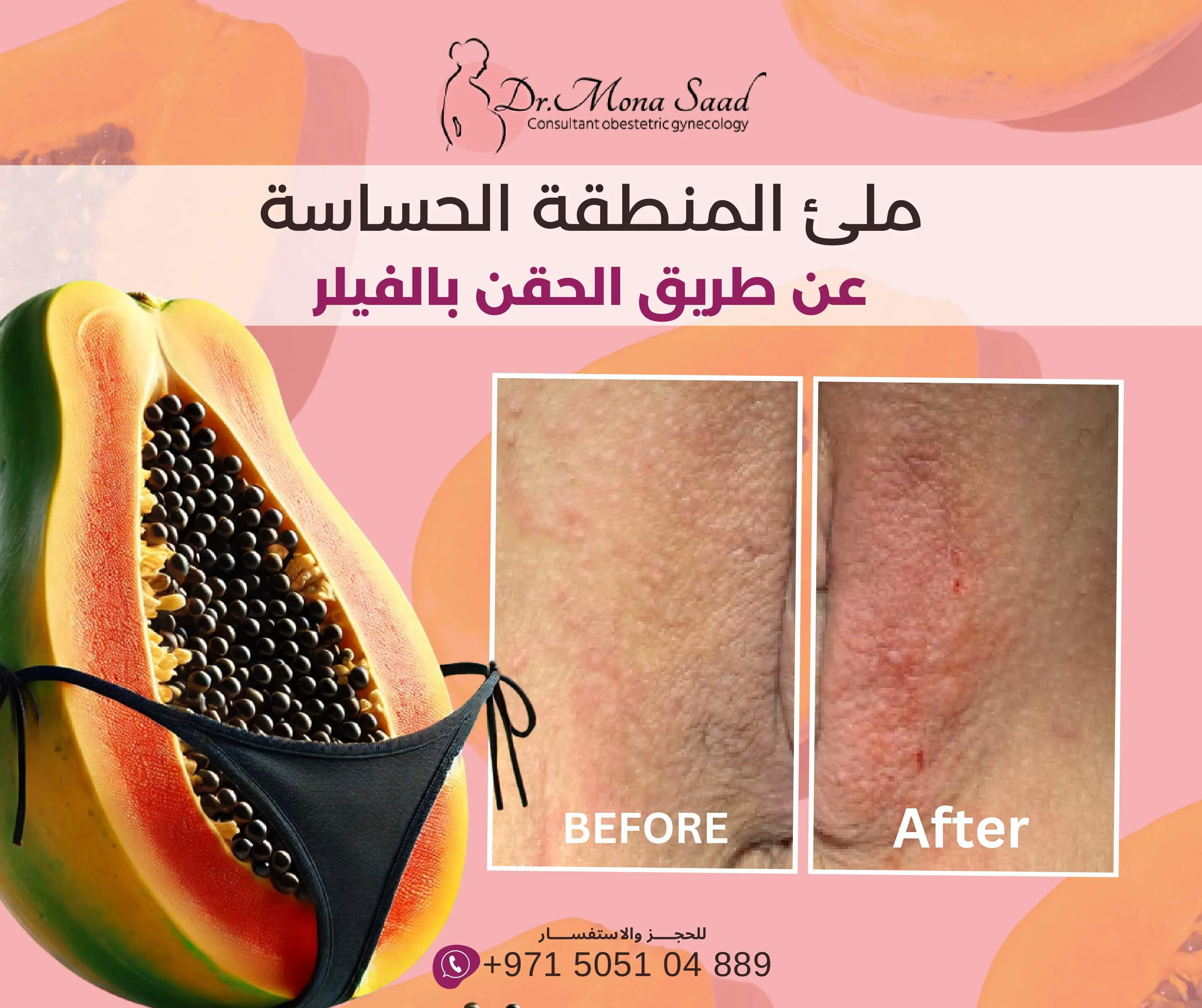 Before / After 1