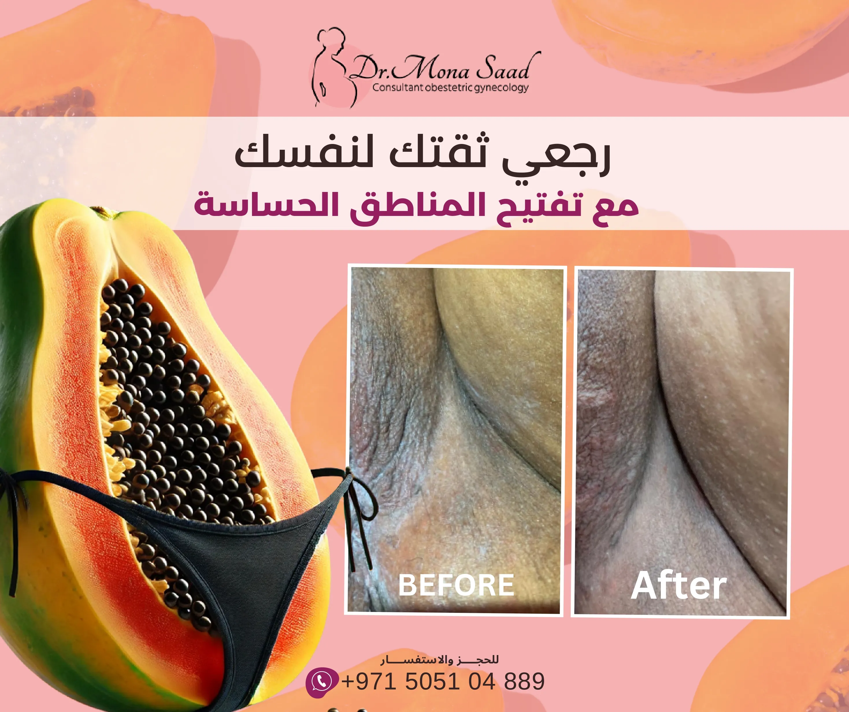 Before / After 3