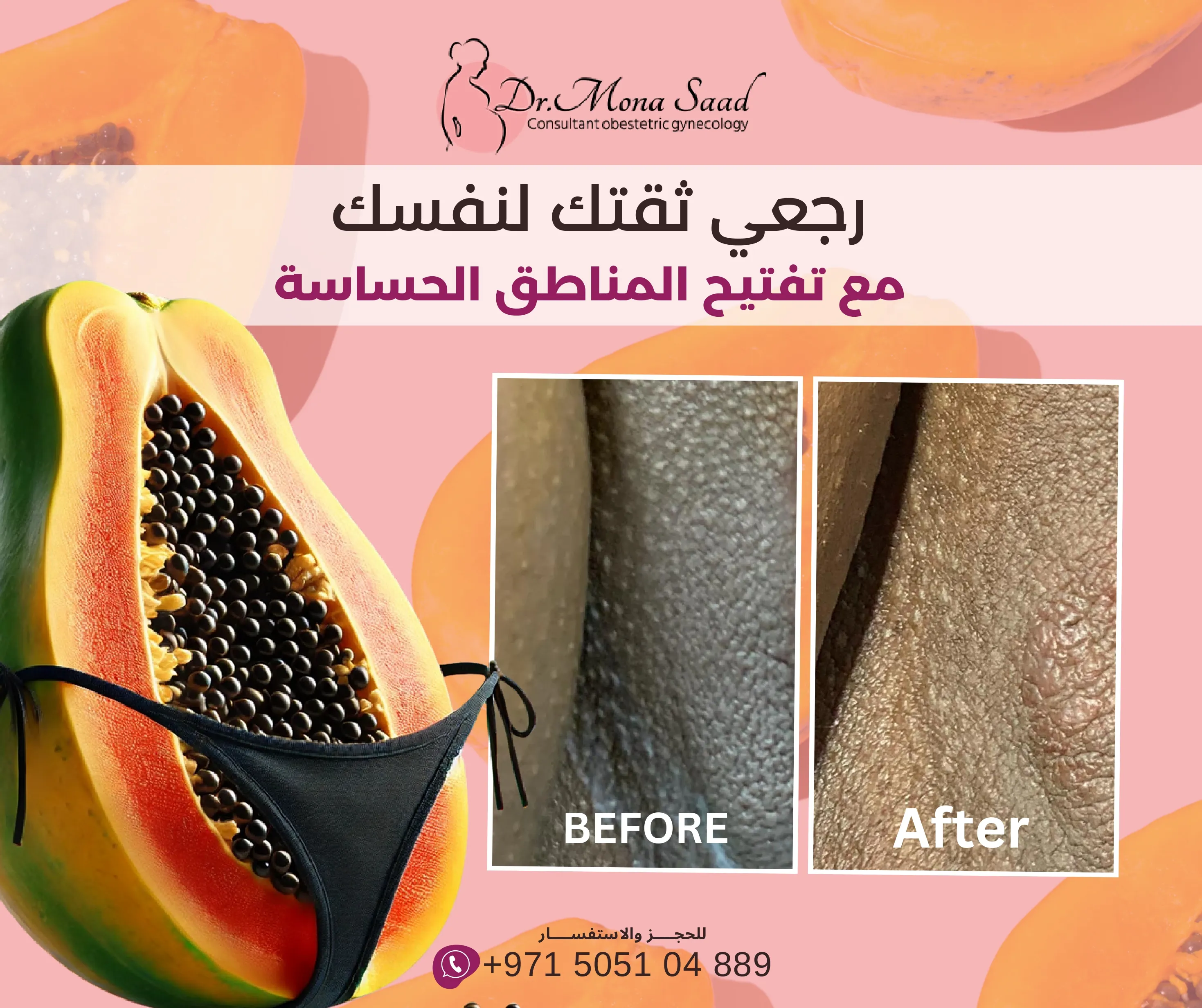 Before / After 2