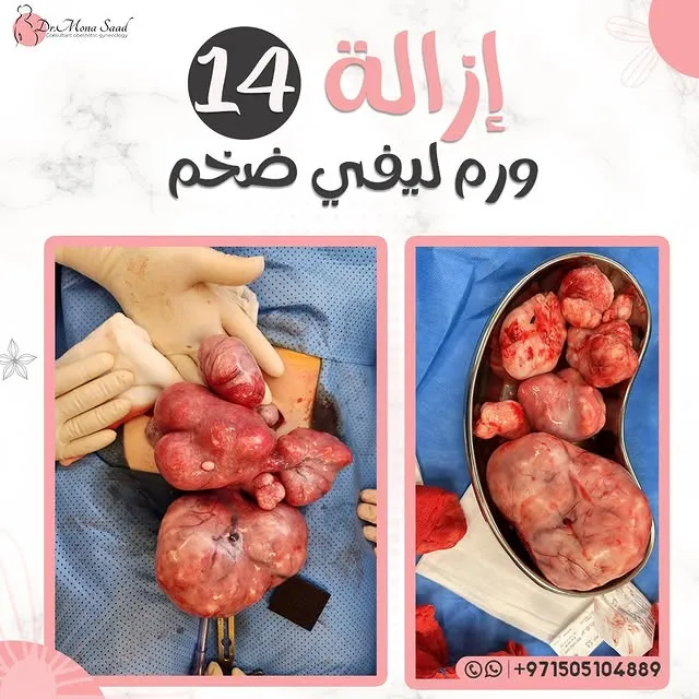 Our case today